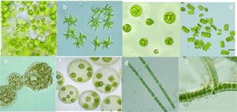  Strombidium! Ein faszinierender Einzeller mit wirbelnden Zilien und einer Vorliebe für Mikroalgen!