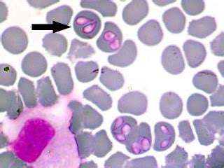  Babesia: Ein Parasit, der sich heimlich durch den Blutkreislauf schleicht und bei seinen Wirten Fieber auslöst!