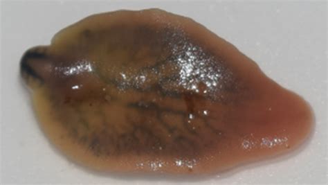  Blood Fluke: A Tiny Terror that Hides in Plain Sight!  Blood flukes are parasitic flatworms with a complex life cycle involving two different hosts - humans and freshwater snails.