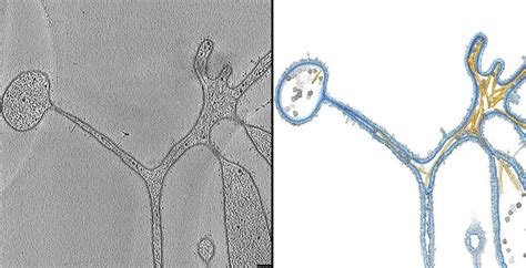  Oxytrichia: Ein winziges Meisterwerk der Bewegung mit komplexen Tentakelstrukturen!