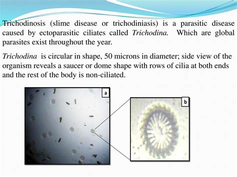  Trichodina: Können winzige Parasiten mit einer Krone aus Zilien wirklich ein komplettes Ökosystem beeinflussen?