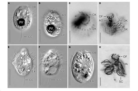  Urotricha! Ein faszinierender Ciliate mit unglaublicher Beweglichkeit und erstaunlicher Fähigkeit zur Selbstverteidigung